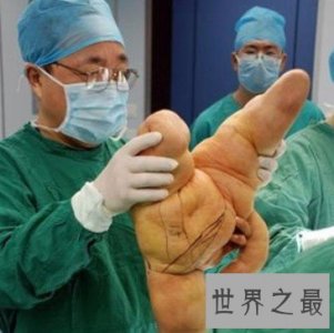 ​世界上最大的手指，长达30厘米