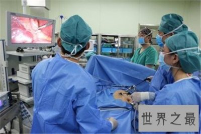 ​切除胆囊的后果很严重 万不得已不能切除胆囊