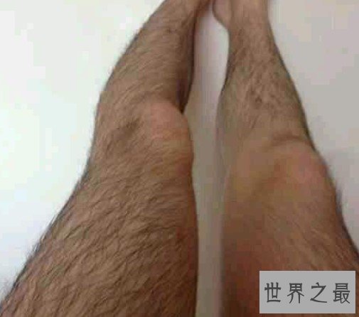 世界上最长的腿毛，其腿毛长到了22.46厘米