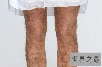 ​世界上最长的腿毛，其腿毛长到了22.46厘米