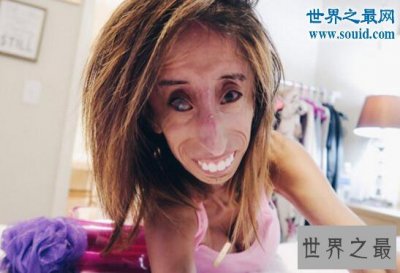 ​世界上最丑的女人，被恶毒诅咒快去死(励志逆袭)