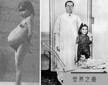 ​世界上最年轻的妈妈，秘鲁5岁女童生子，成年龄最小的妈妈