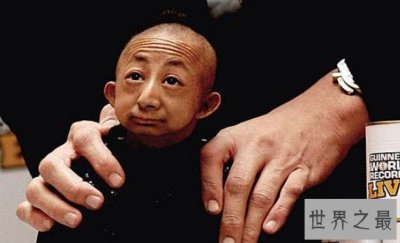 ​世界上体重最轻的成年人，26岁男子仅重11斤
