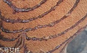 鸡血藤能泡澡吗 泡澡有利于产后恢复
