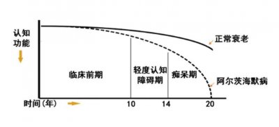 ​阿尔兹海默病走出“技术沉没周期”