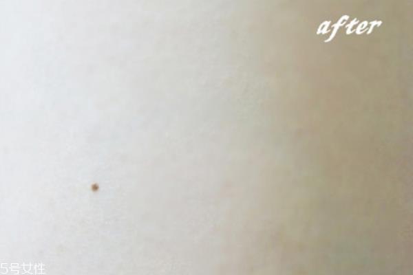 beely身体乳怎么样 鸡皮的好选择