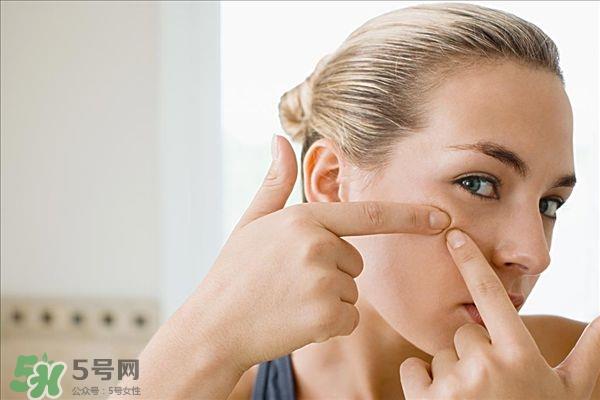 涂防晒后皮肤上长白头怎么办