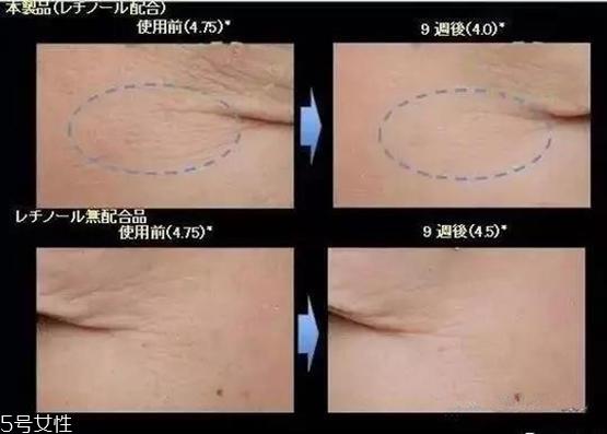 怡丽丝尔抚纹眼霜什么味道 怡丽丝尔抚纹眼霜香味