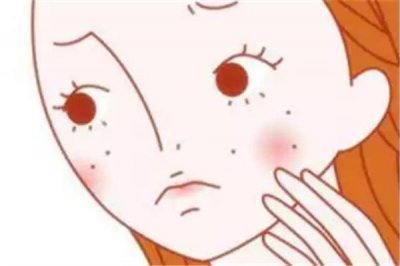 ​闭口粉刺怎么可以有效去除 闭口粉刺是什么原因引起的