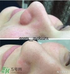 natura bisse清洁面膜怎么用?natura bisse清洁面膜用法