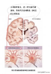​熬夜会让人变傻，是真的吗？