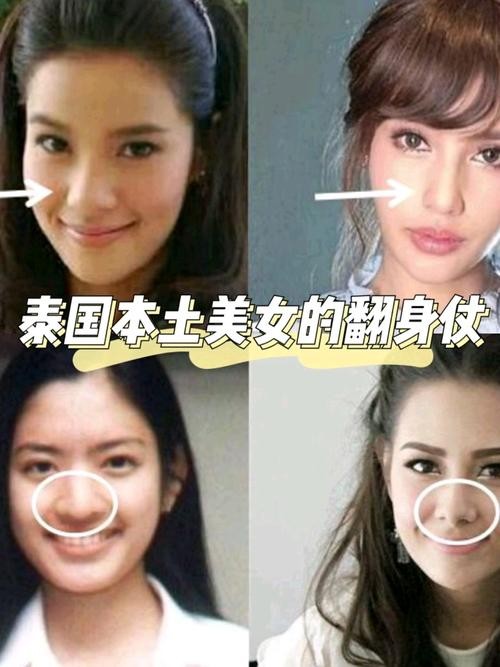 崔胜贤整容，权志龙崔胜贤恋情,本文共（1133字）