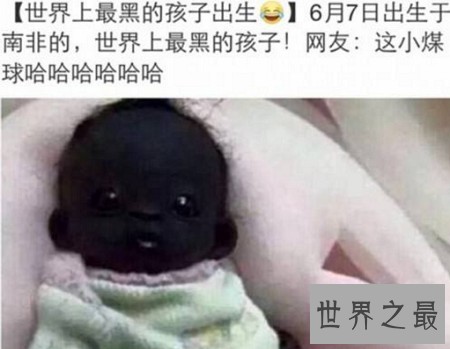 看世界上最黑的孩子，世界史无前例的黑你意想不到