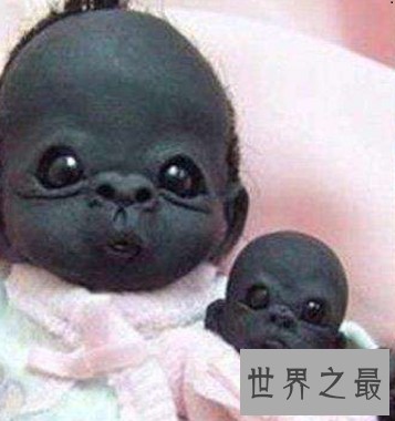 看世界上最黑的孩子，世界史无前例的黑你意想不到