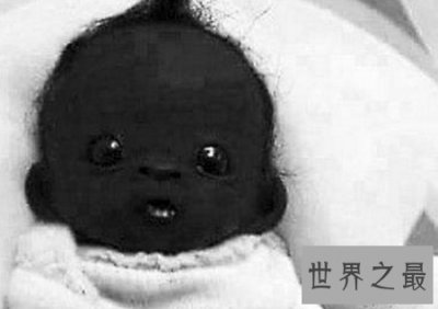 ​看世界上最黑的孩子，世界史无前例的黑你意想不到