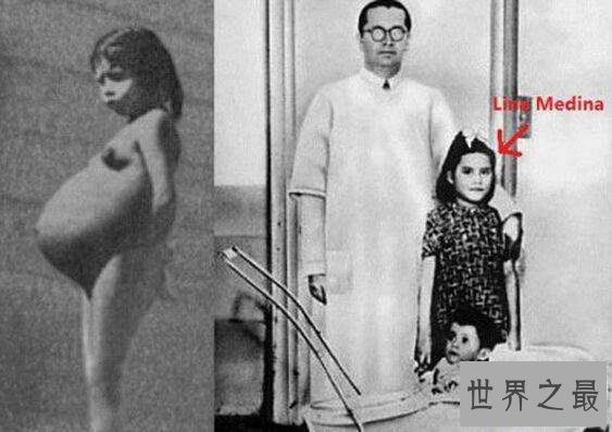 盘点世界最小母亲,琳娜·玛迪纳5岁就当妈