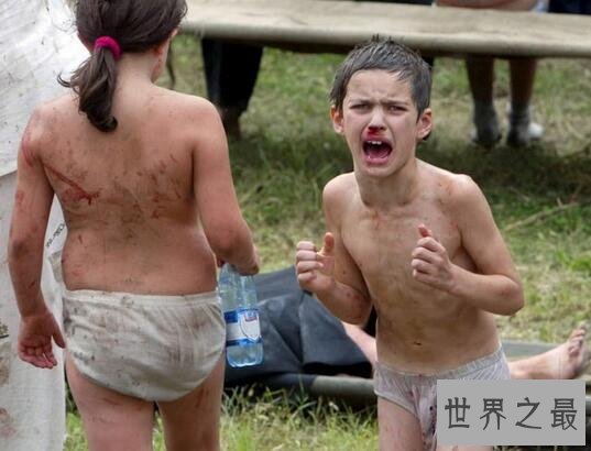 世界十大恐怖事件,日本东京地铁5500人中毒