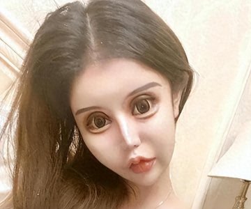 ​00后整容狂人：13岁开始整容，4年花400万“削骨”，如今模样可怖