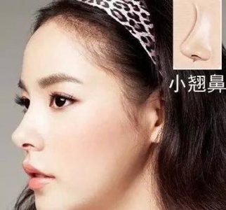 ​精致的小翘鼻一定就人人都合适吗？