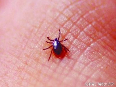 ​郊外常见的小虫，俗称“草爬子”，遇见一定要远离它