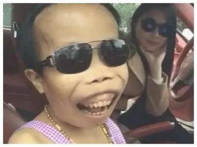 ​外星人”陈山：凭畸形脸走红，巅峰时美女相伴，被封杀后怎样了