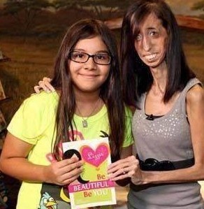 女子高1.57米体重54斤，被称为“骷髅女孩”