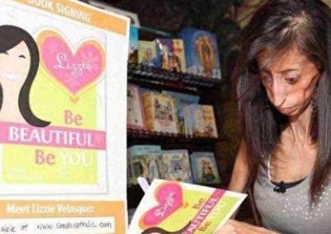 女子高1.57米体重54斤，被称为“骷髅女孩”